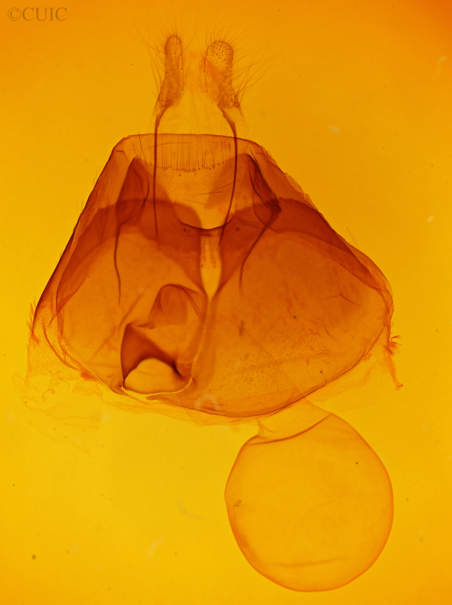 genitalia view of adult Zale calycanthata