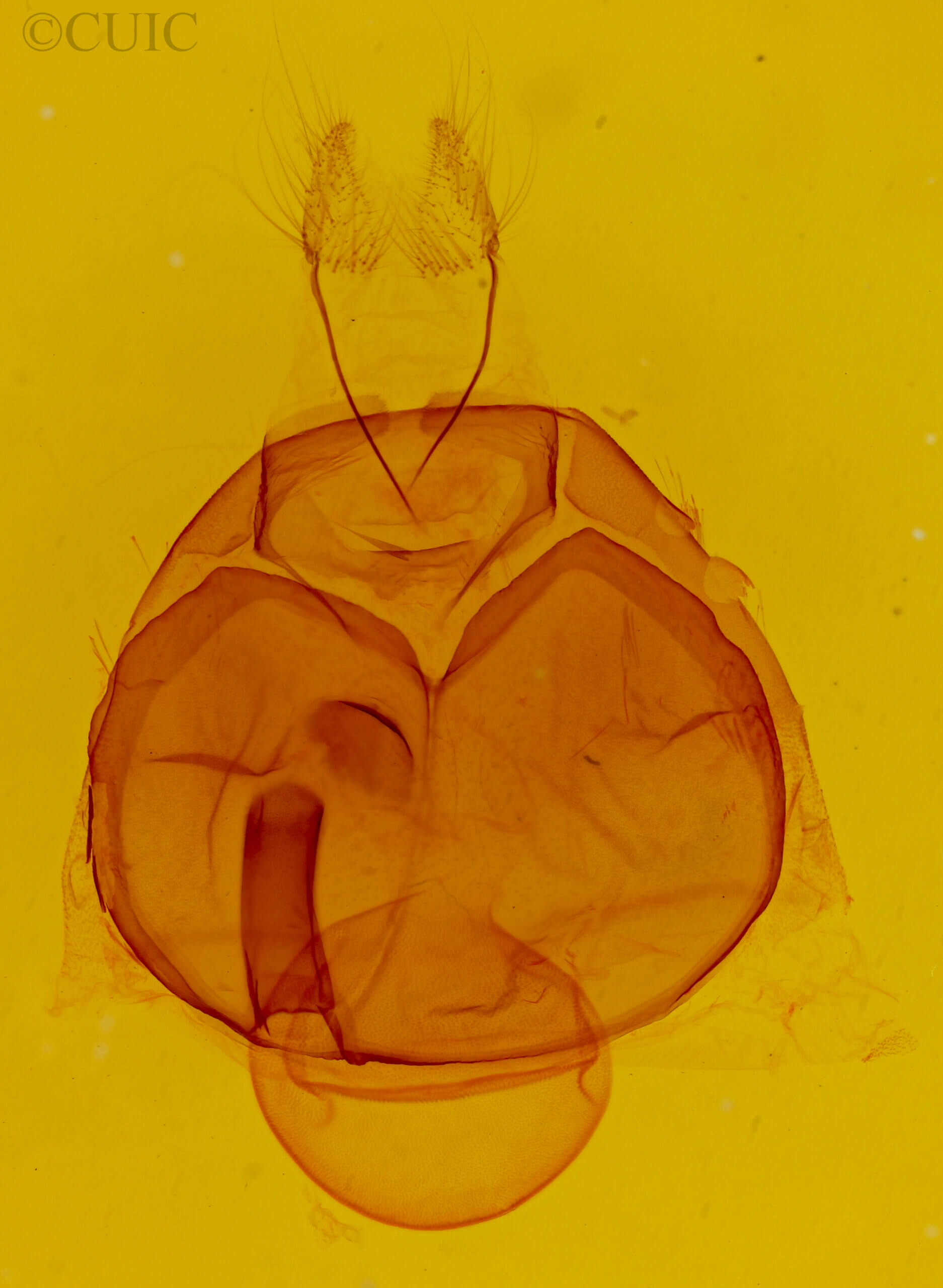 genitalia view of adult Zale aeruginosa