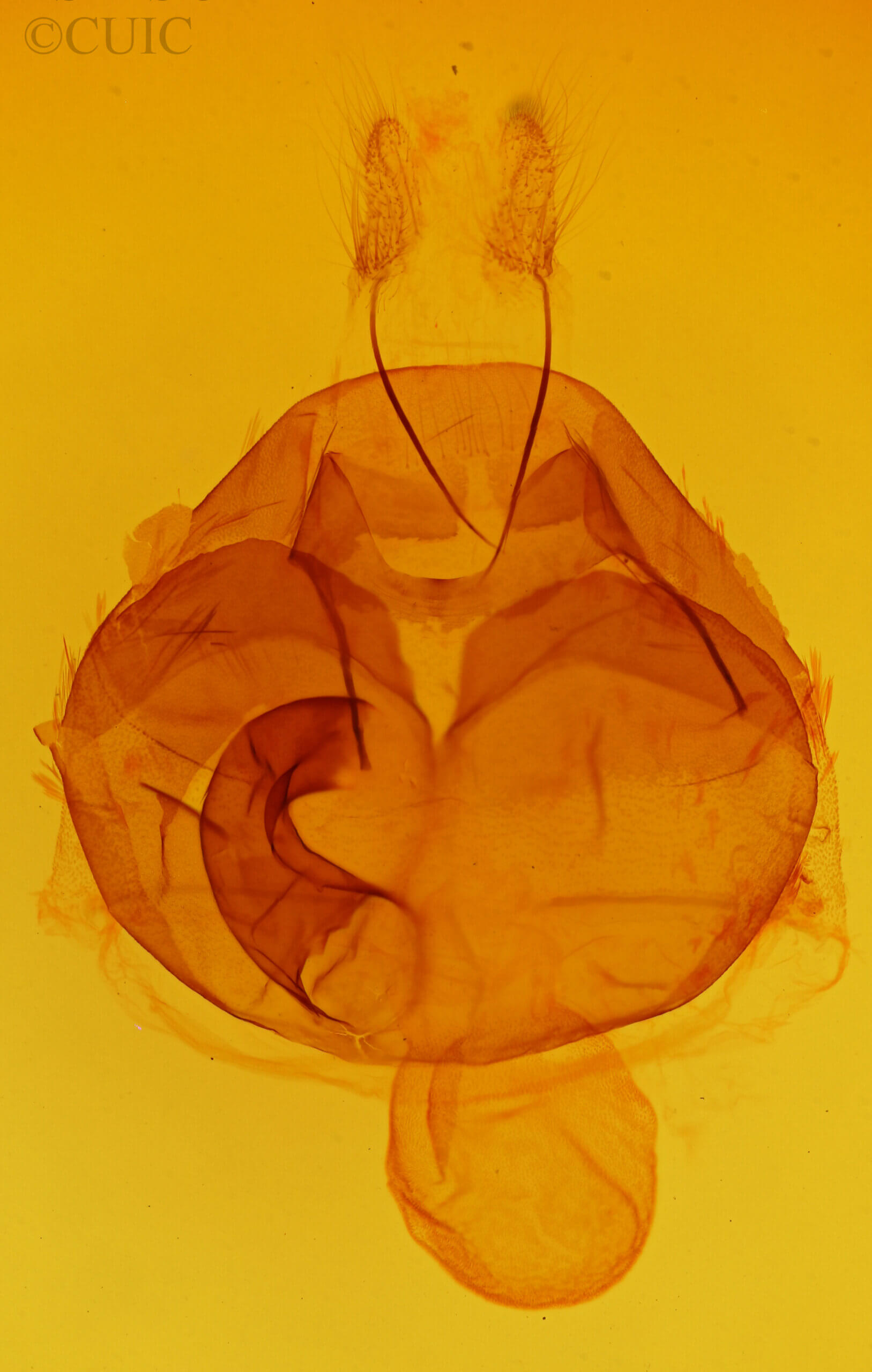 genitalia view of adult Zale undularis