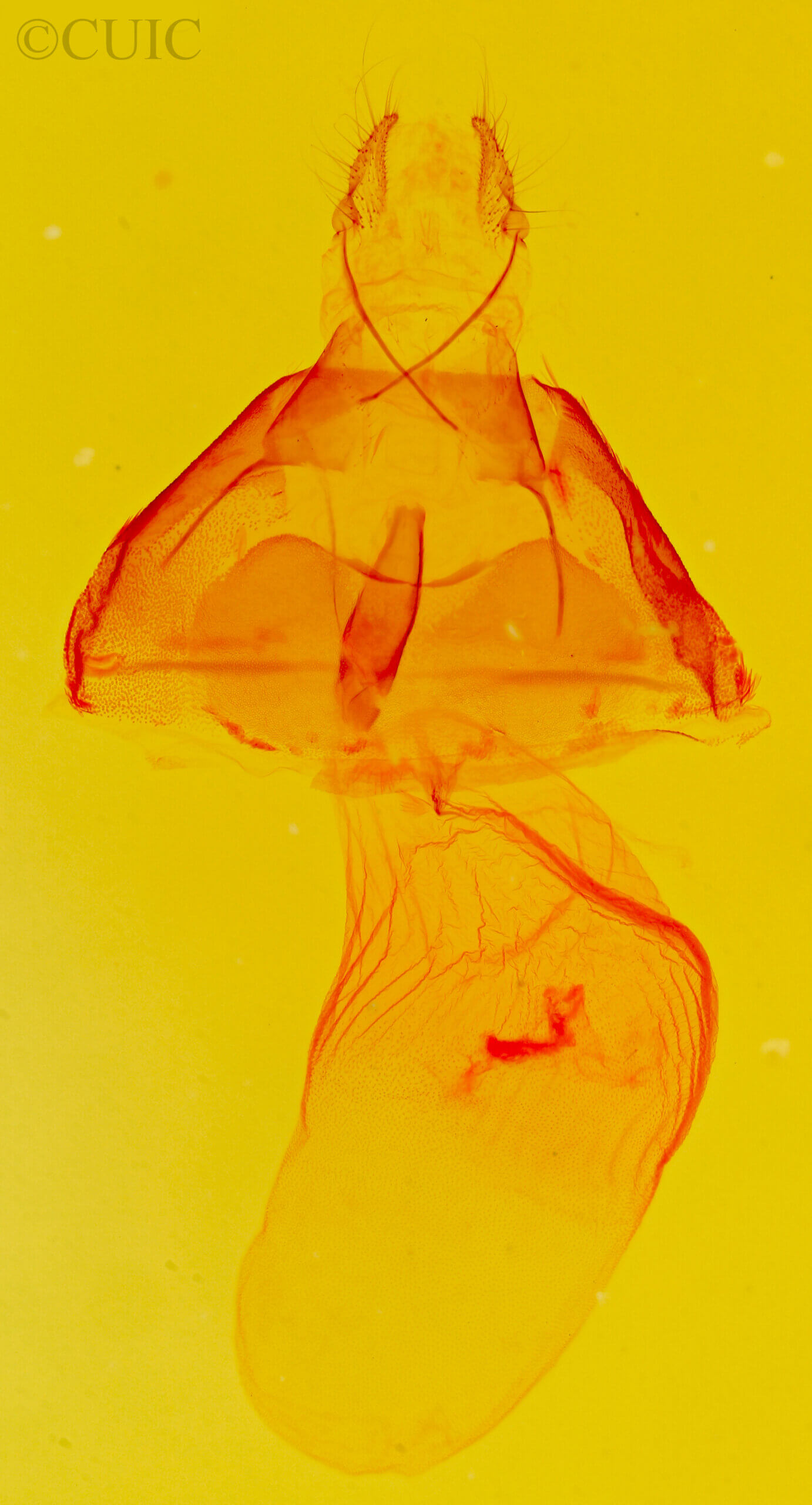 genitalia view of adult Ptichodis bucetum