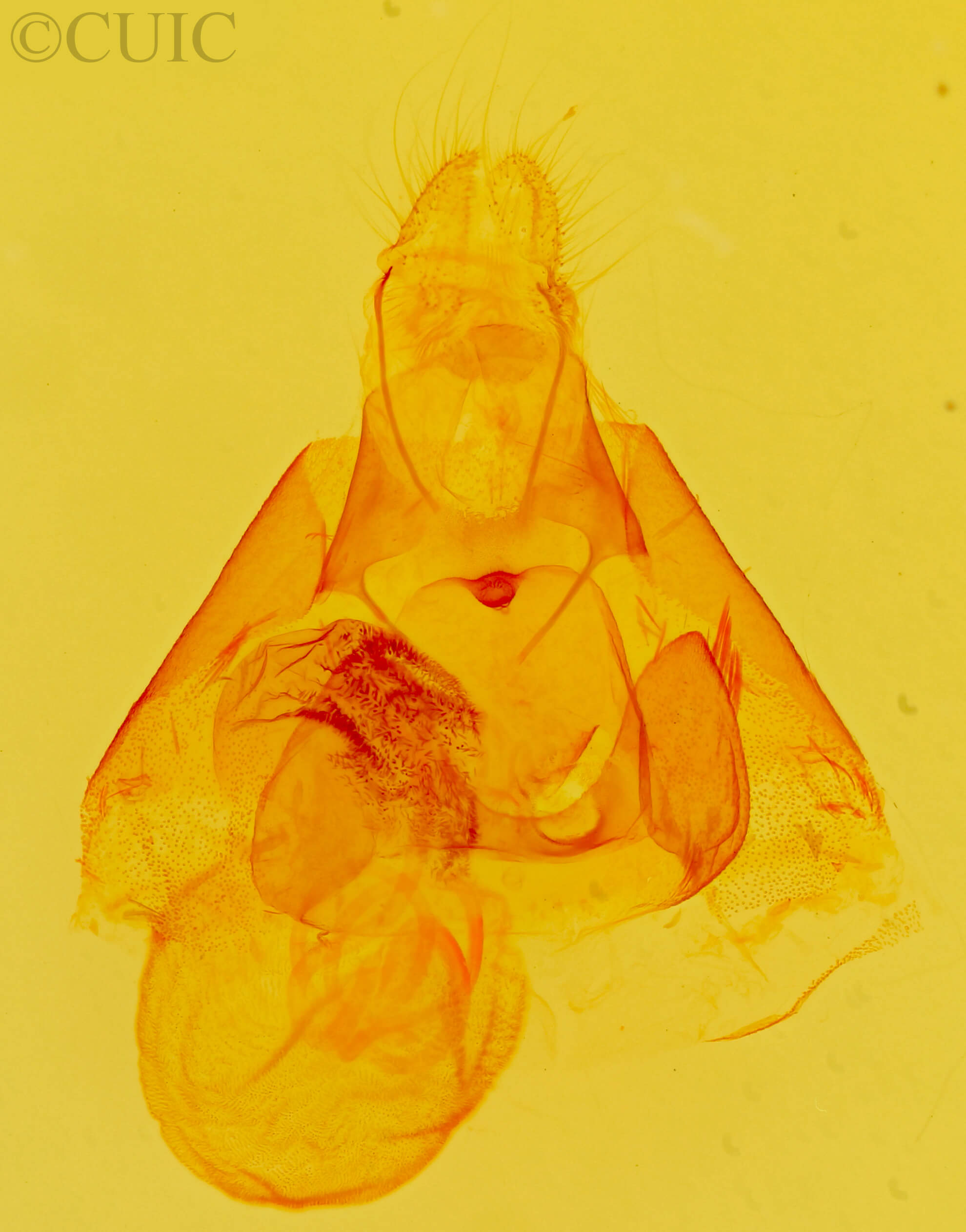 genitalia view of adult Argyrostrotis quadrifilaris