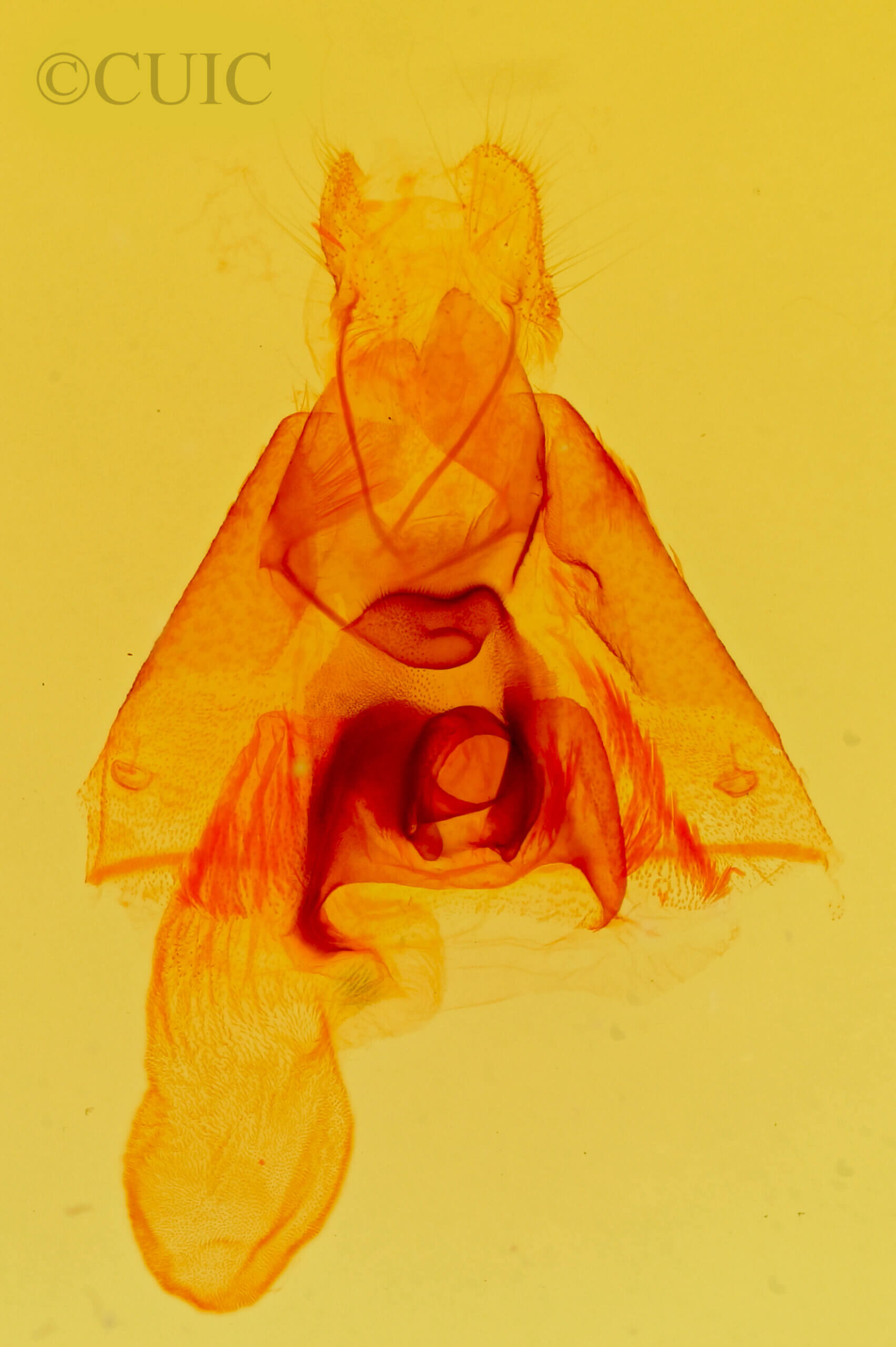 genitalia view of adult Argyrostrotis erasa