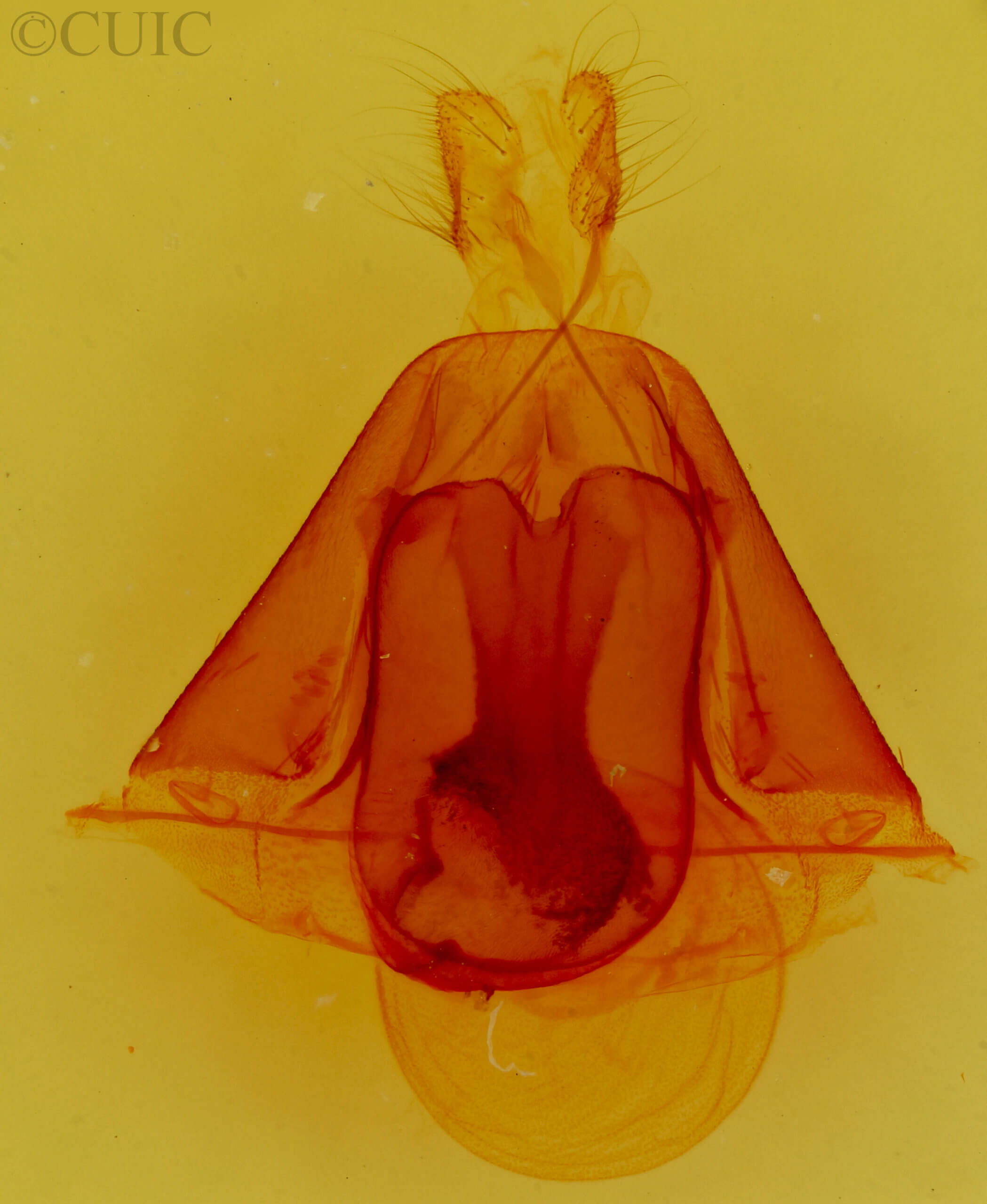 genitalia view of adult Ptichodis vinculum