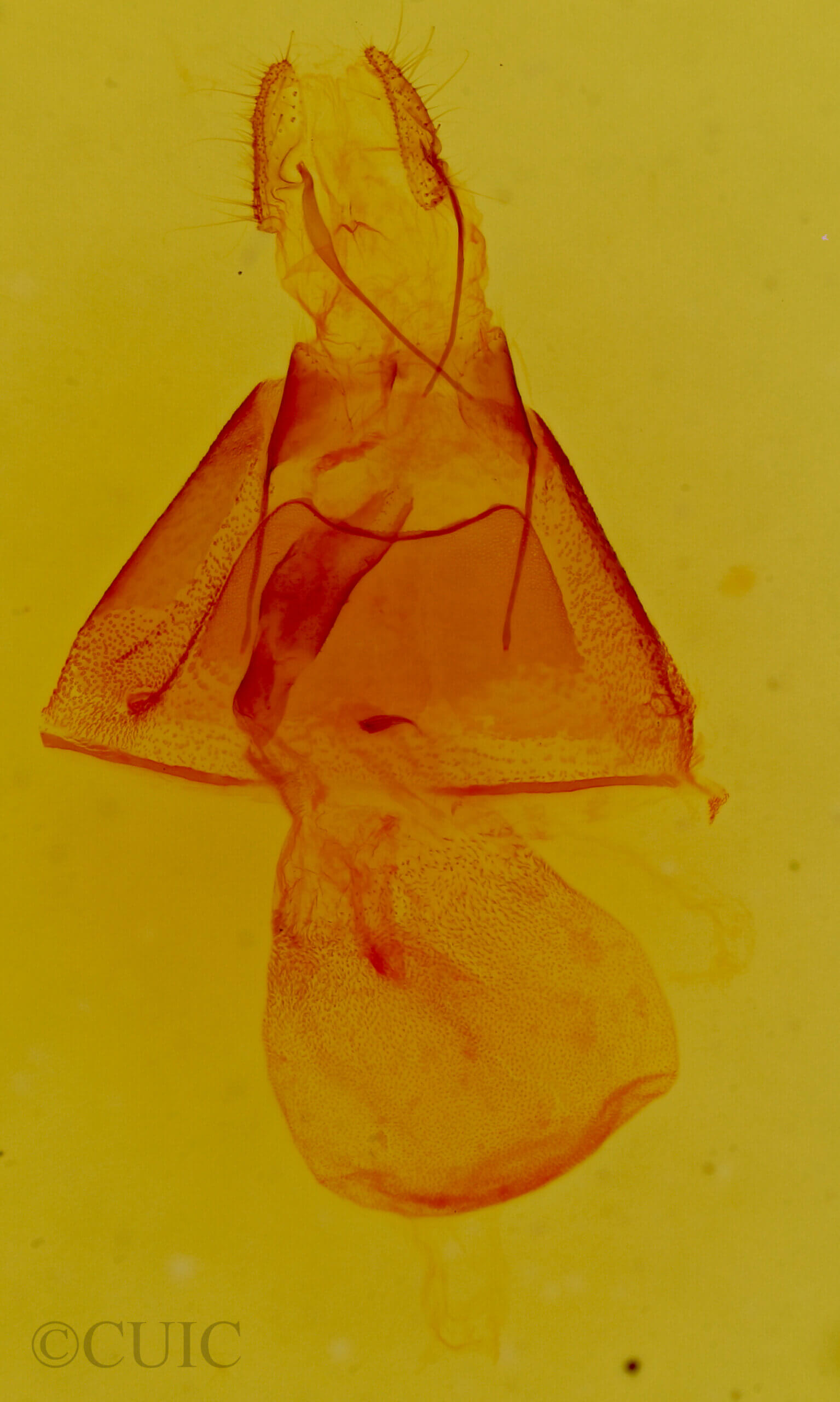 genitalia view of adult Ptichodis bistrigata