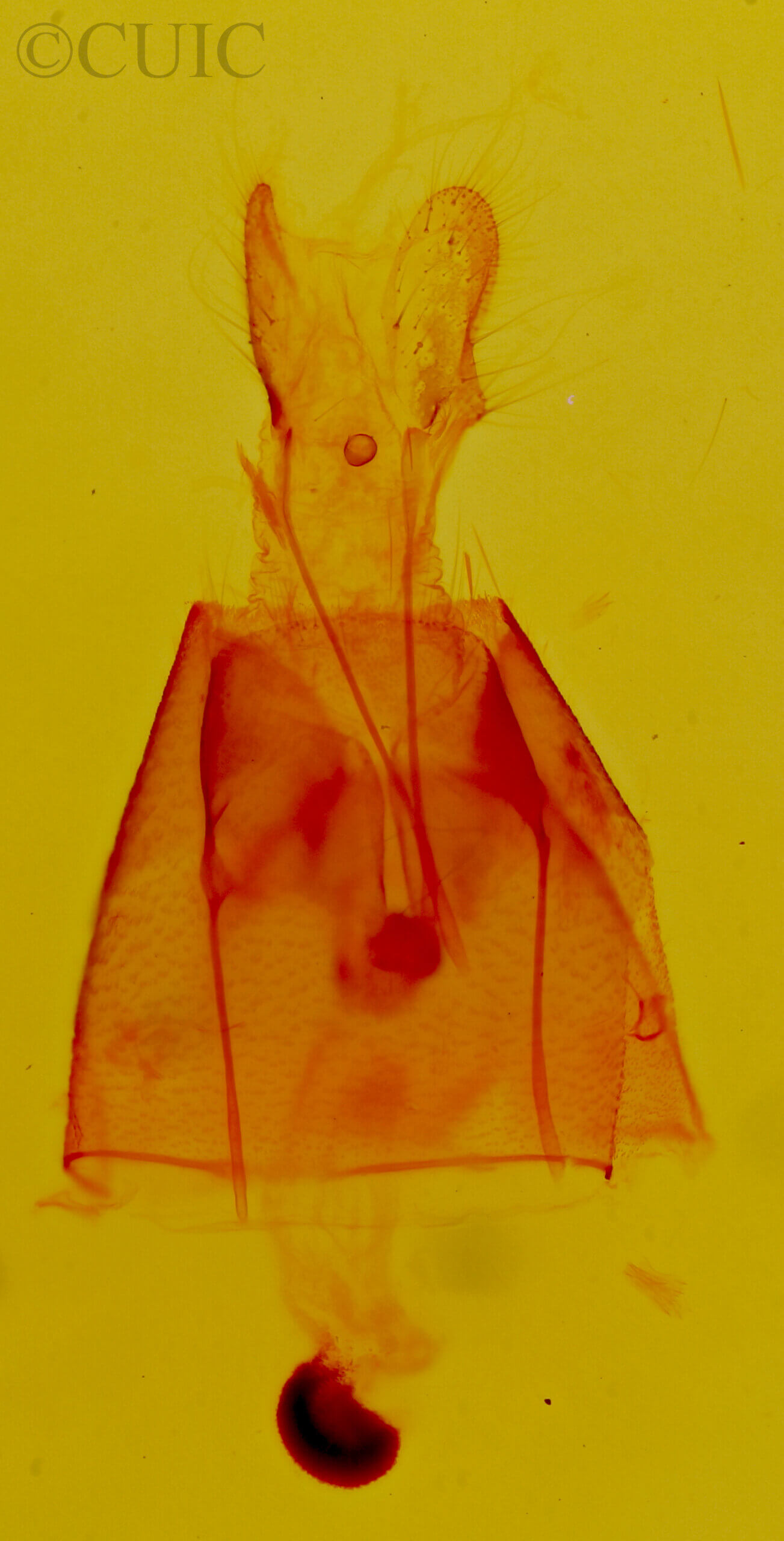 genitalia view of adult Focillidia texana