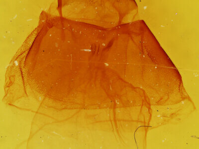 genitalia view of adult Acronicta impressa