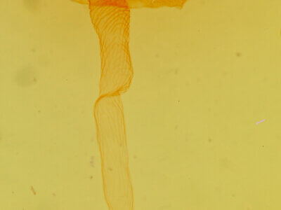 genitalia view of adult Pronoctua pyrophiloides