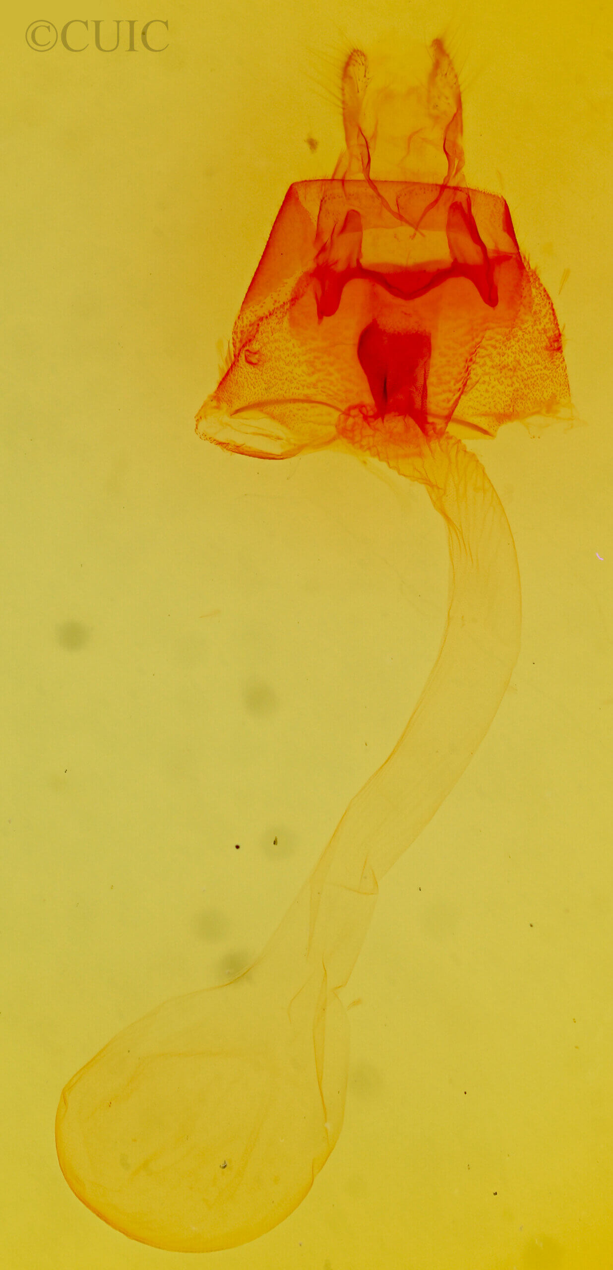 genitalia view of adult Pronoctua tyipca
