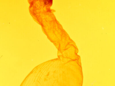 genitalia view of adult Anicla sp.