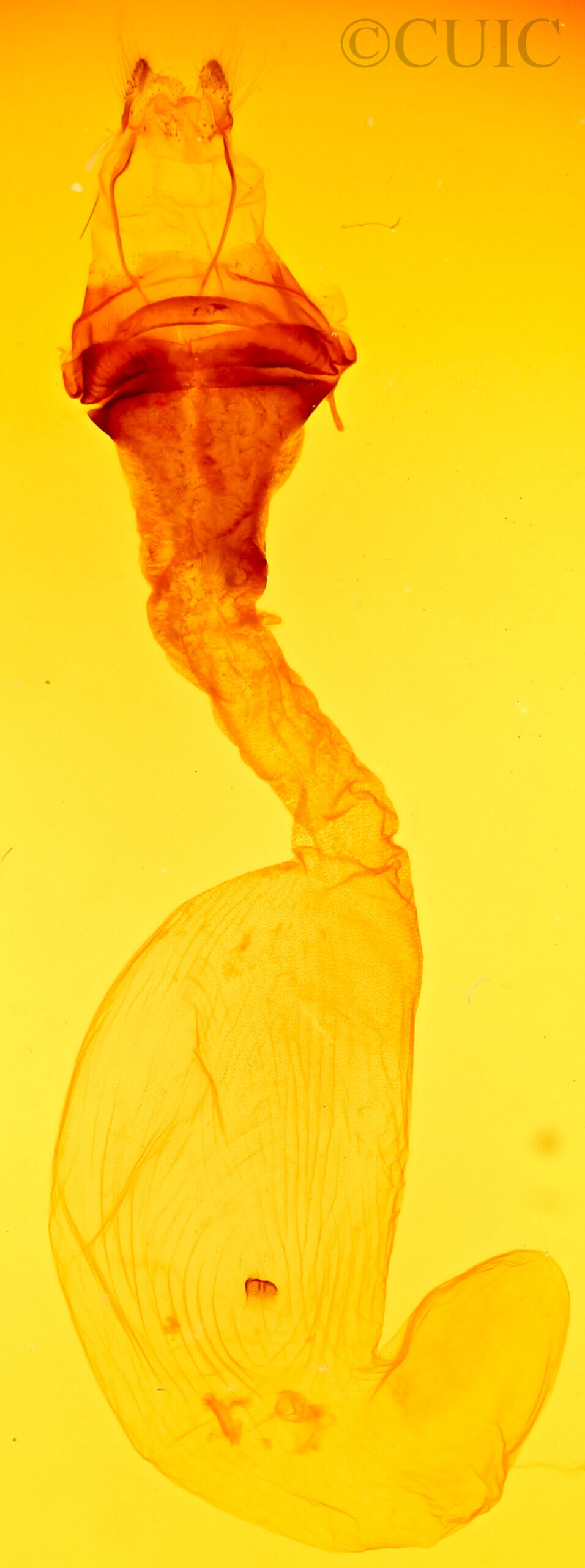 genitalia view of adult Anicla sp.