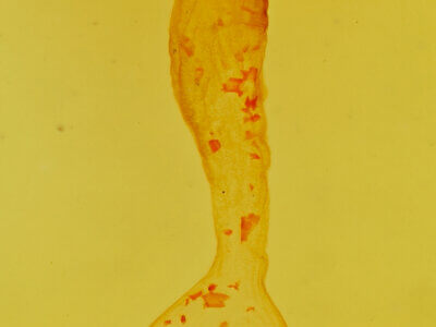 genitalia view of adult Anicla exuberans