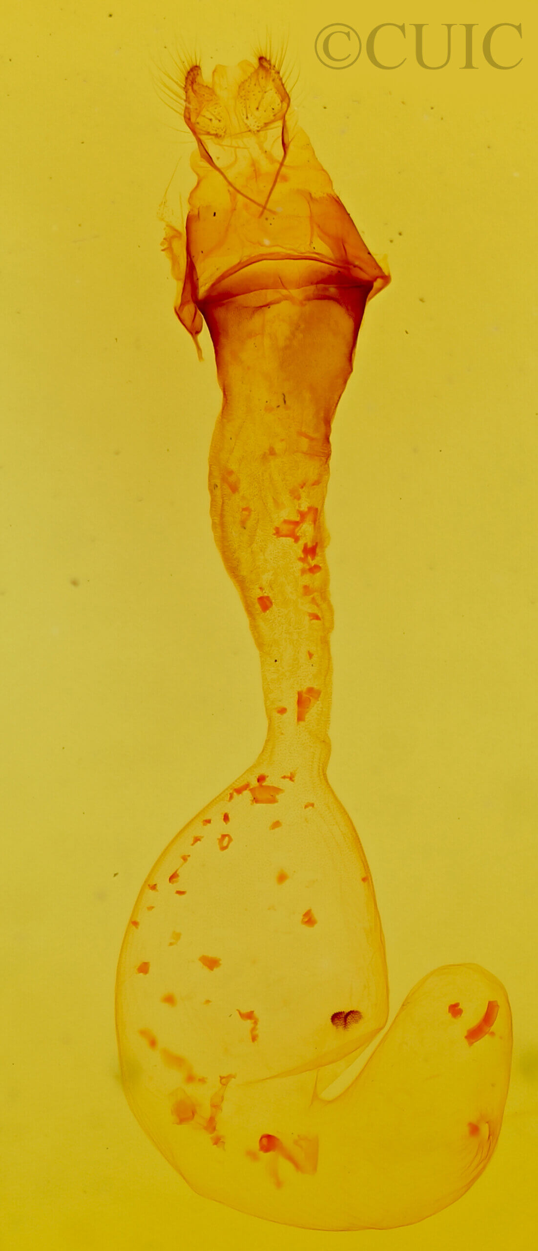 genitalia view of adult Anicla exuberans