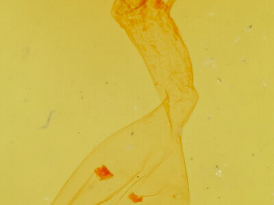 genitalia view of adult Anicla digna