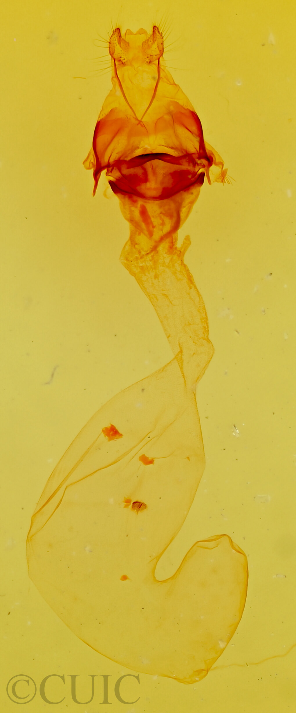 genitalia view of adult Anicla digna