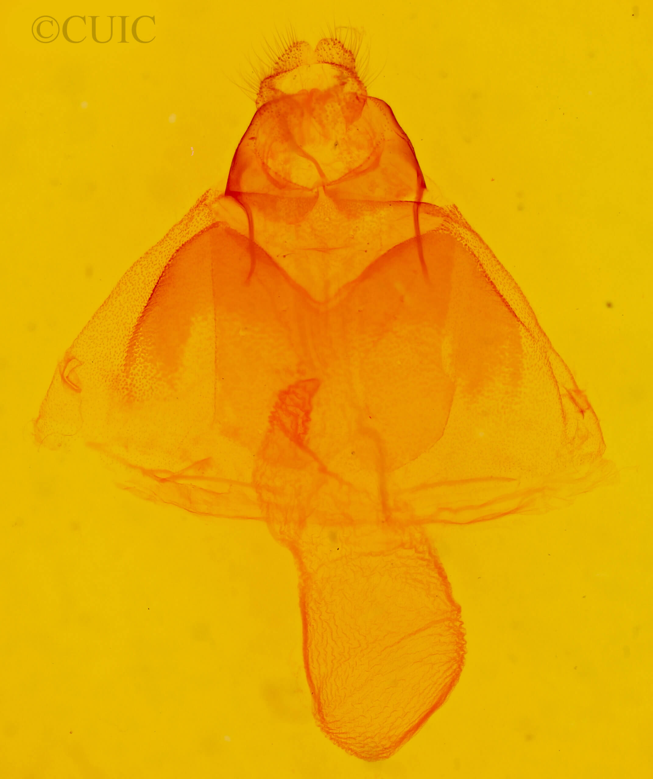 genitalia view of adult Acronicta oblinita