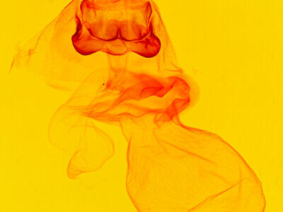 genitalia view of adult Acronicta retardata