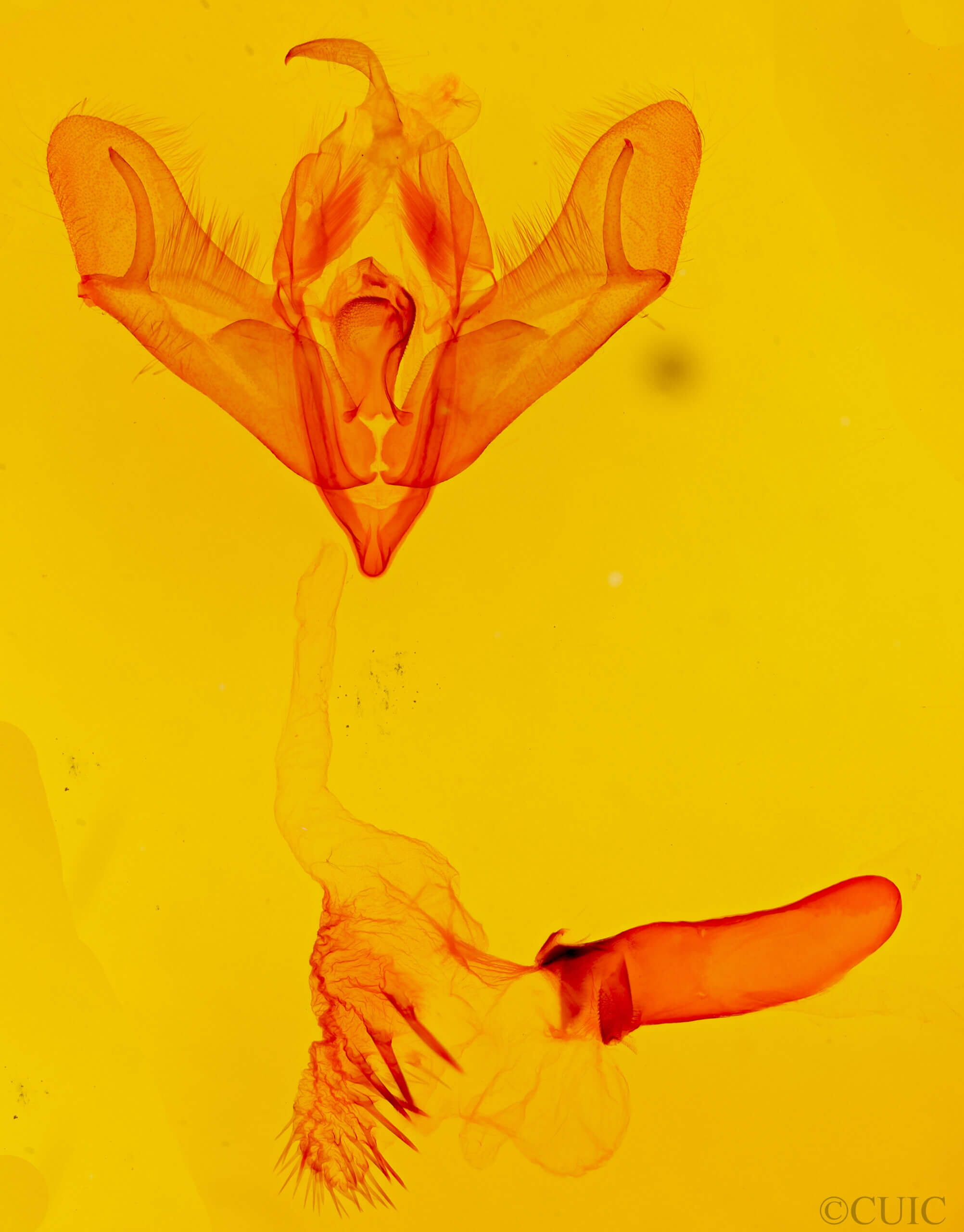 genitalia view of adult Acronicta edolata