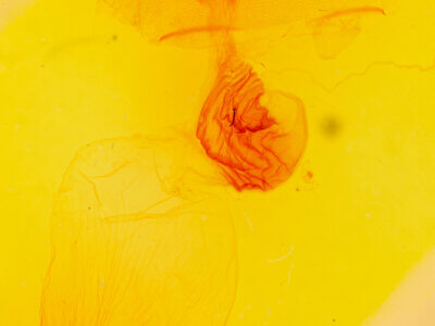 genitalia view of adult Acronicta americana