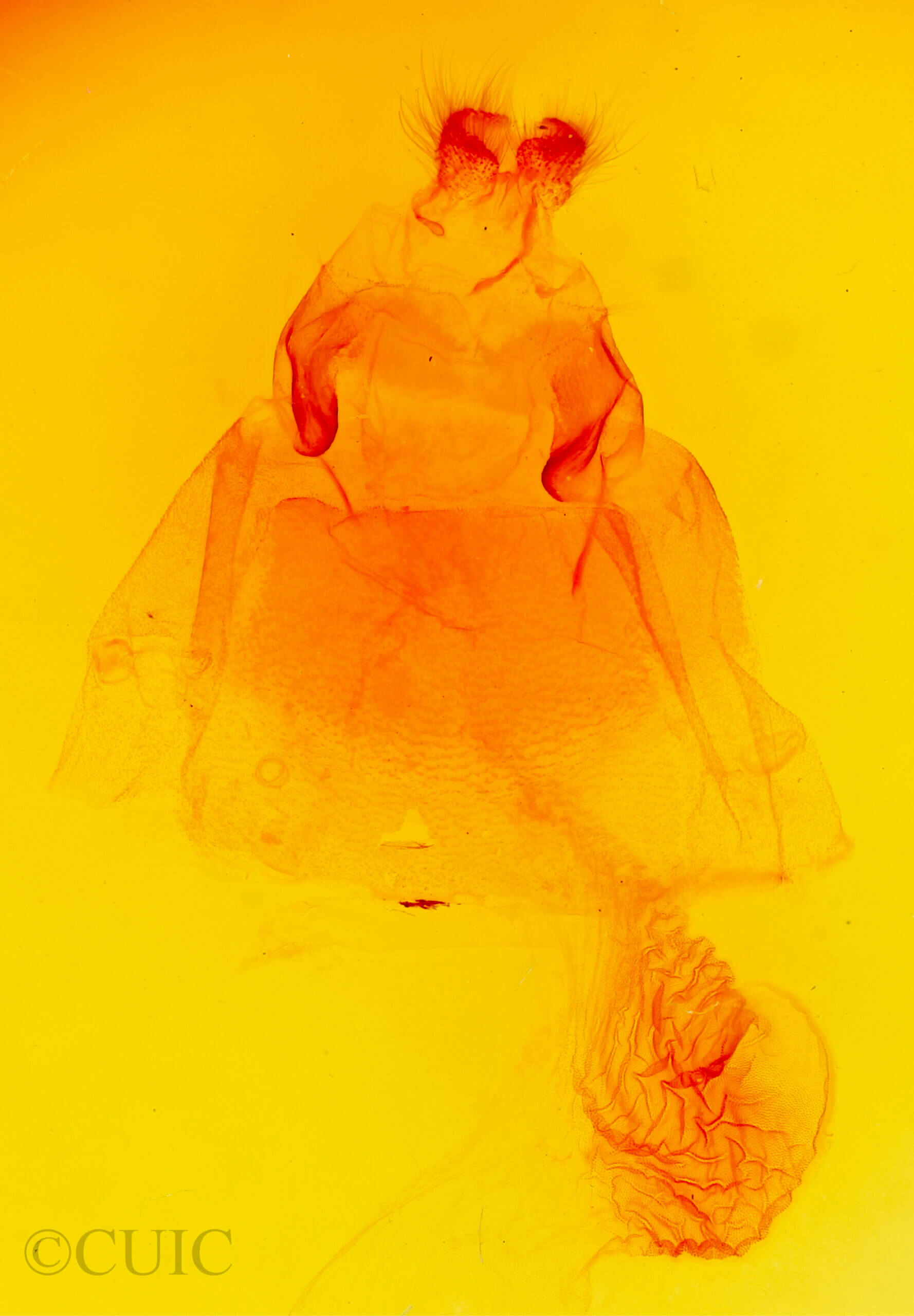 genitalia view of adult Acronicta americana eldora