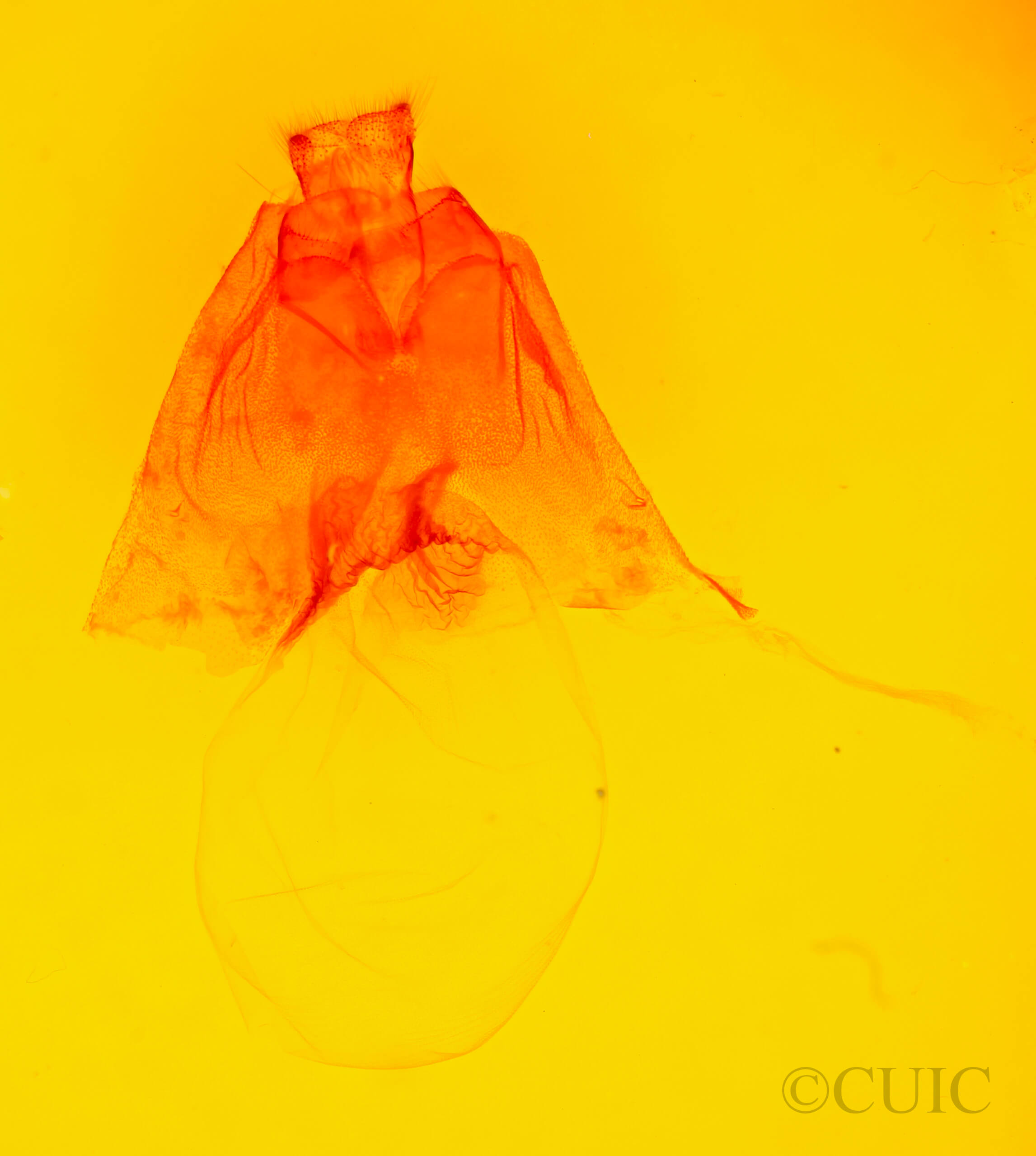 genitalia view of adult Harrisimemna trisignata