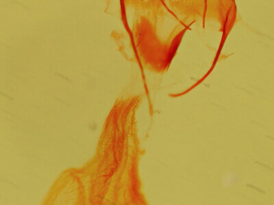 genitalia view of adult Exyra fax