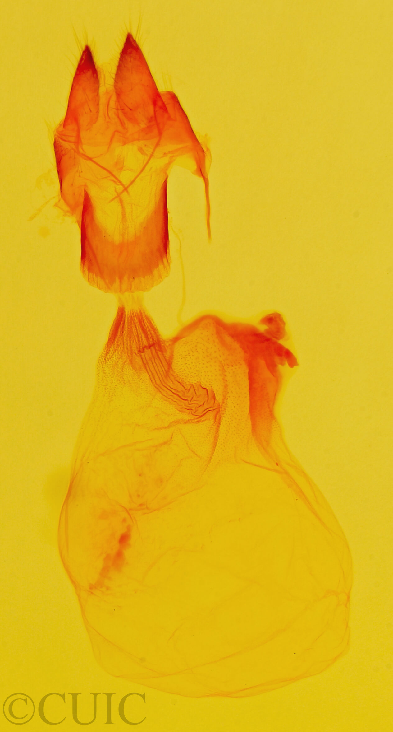 genitalia view of adult Exyra semicrocea