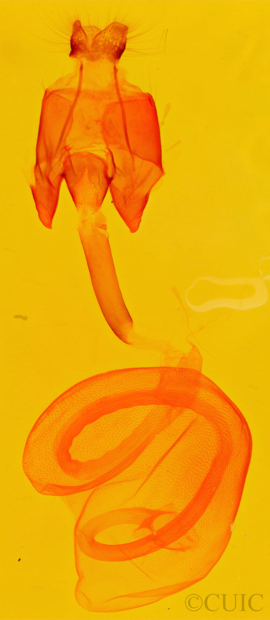 genitalia view of adult Eutelia sp.