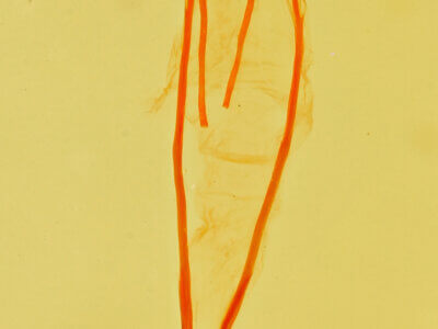 genitalia view of adult Idia aemula