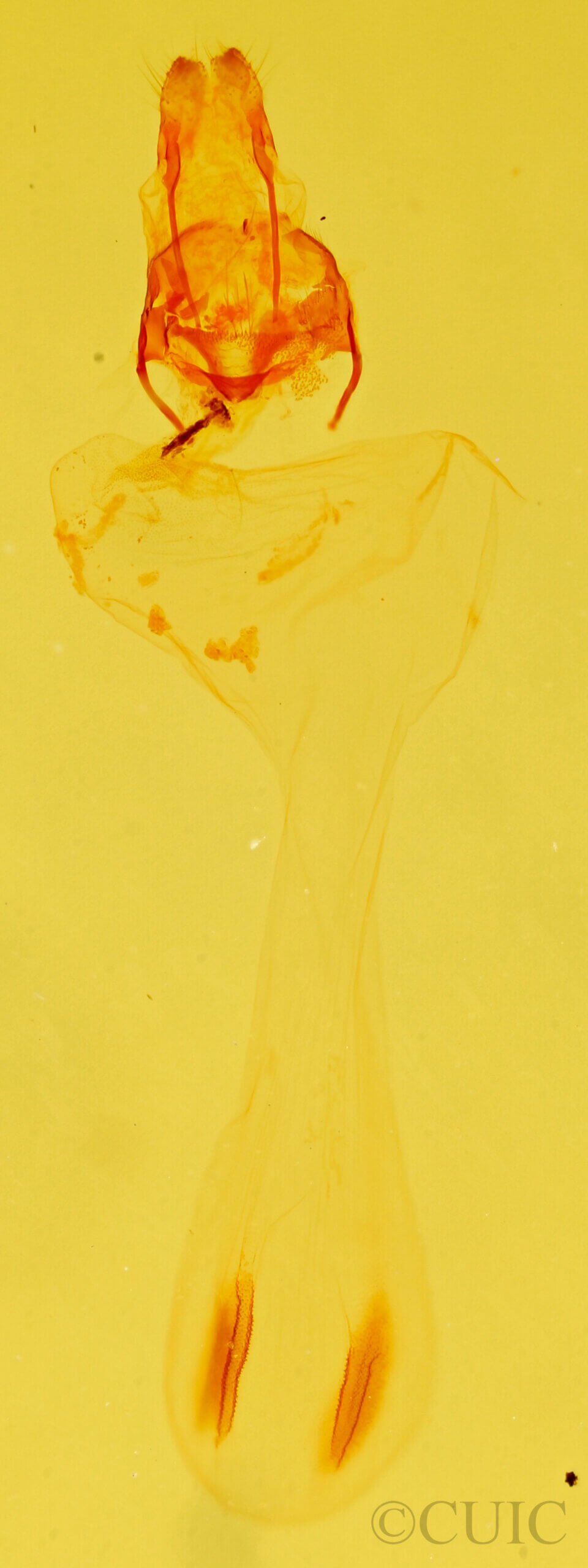 genitalia view of adult Chytonix sensilis