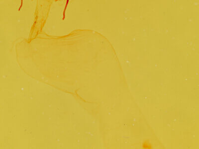 genitalia view of adult Chytonix sensilis