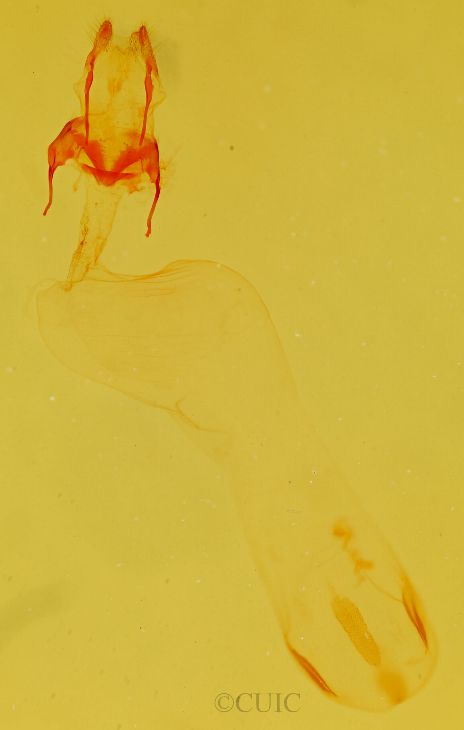 genitalia view of adult Chytonix sensilis