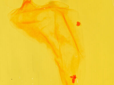 genitalia view of adult Chytonix sensilis