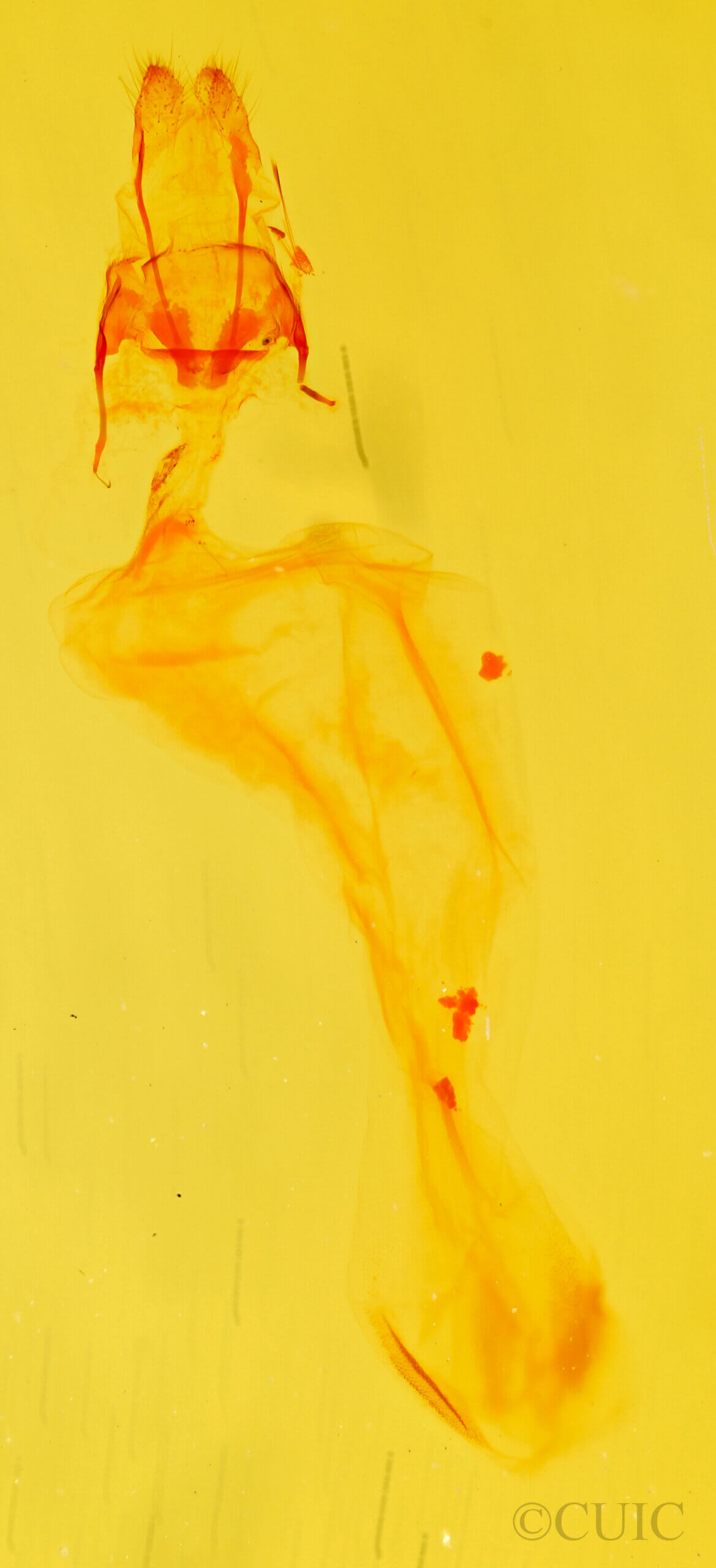 genitalia view of adult Chytonix sensilis