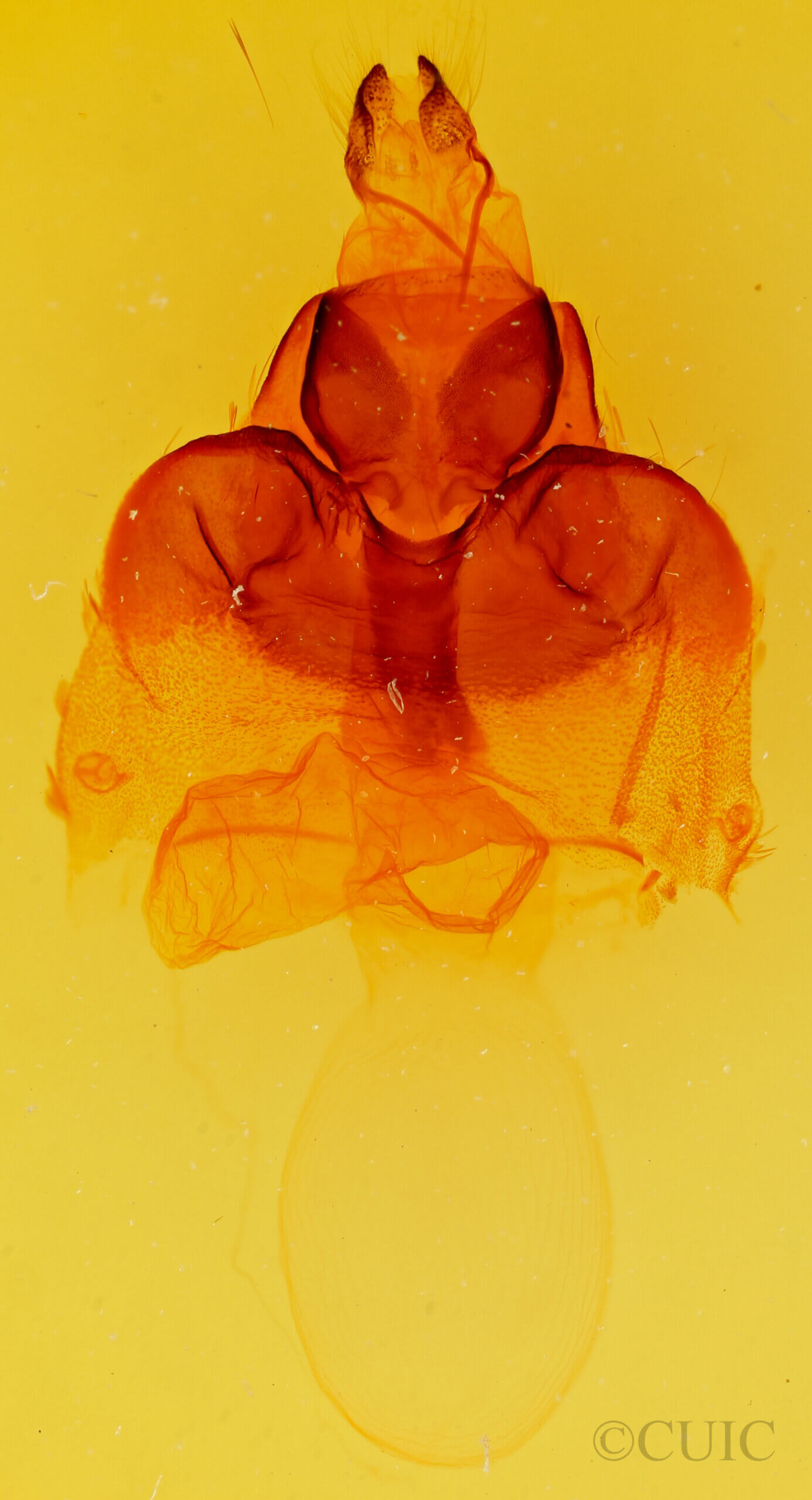 genitalia view of adult Mamestra curialis