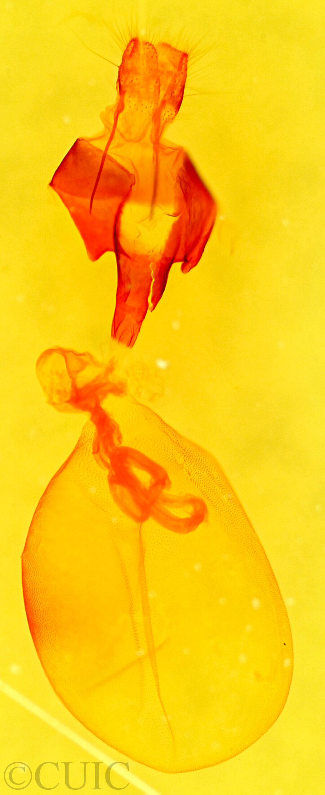 genitalia view of adult Marathyssa basalis