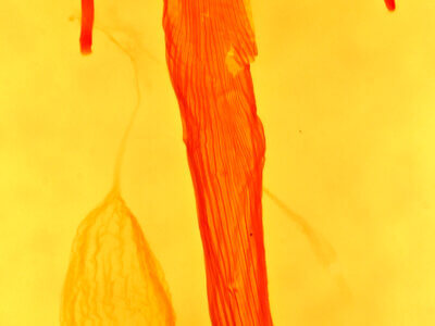 genitalia view of adult Leucania sp.