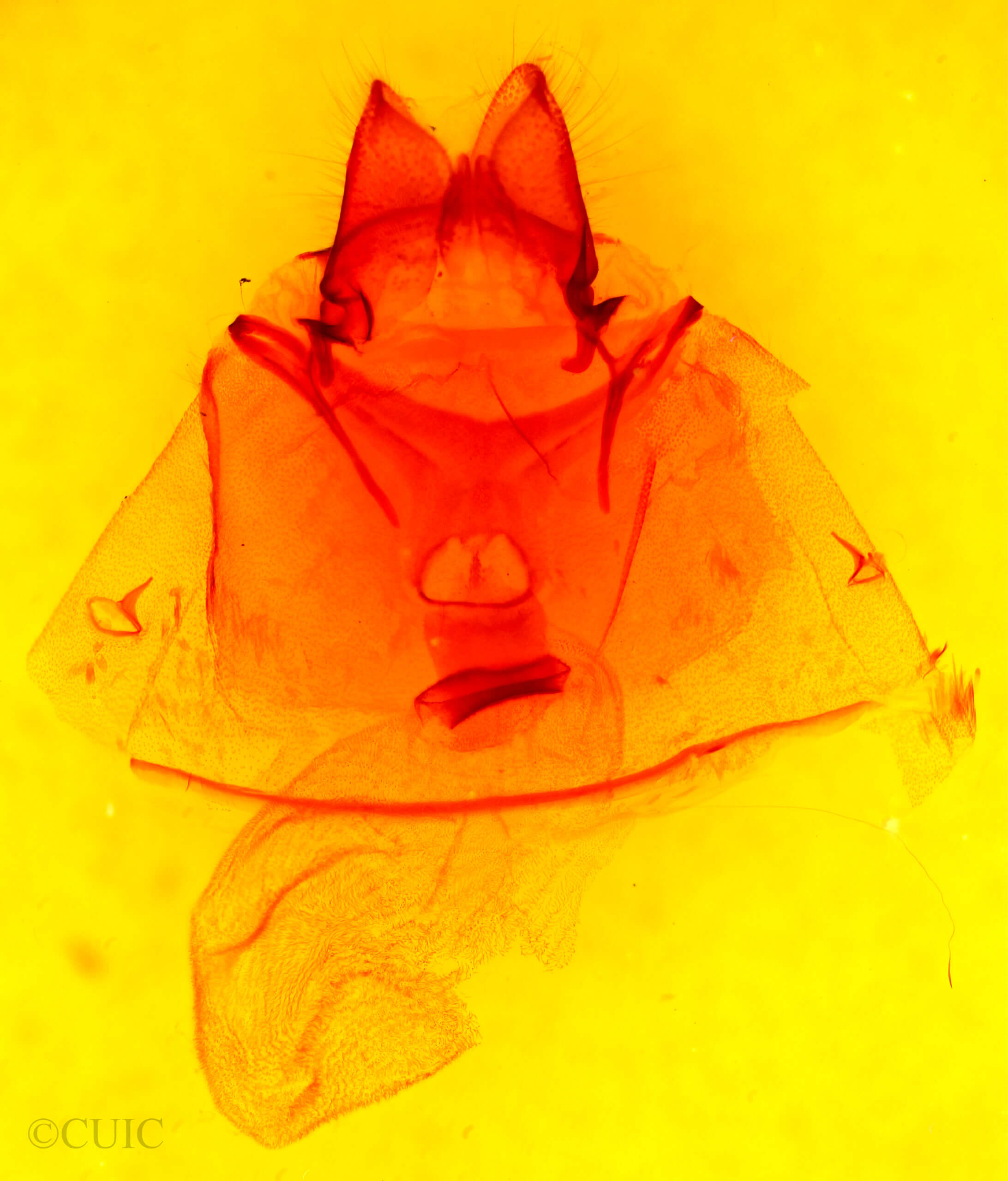 genitalia view of adult Pseudohemihyalea labecula