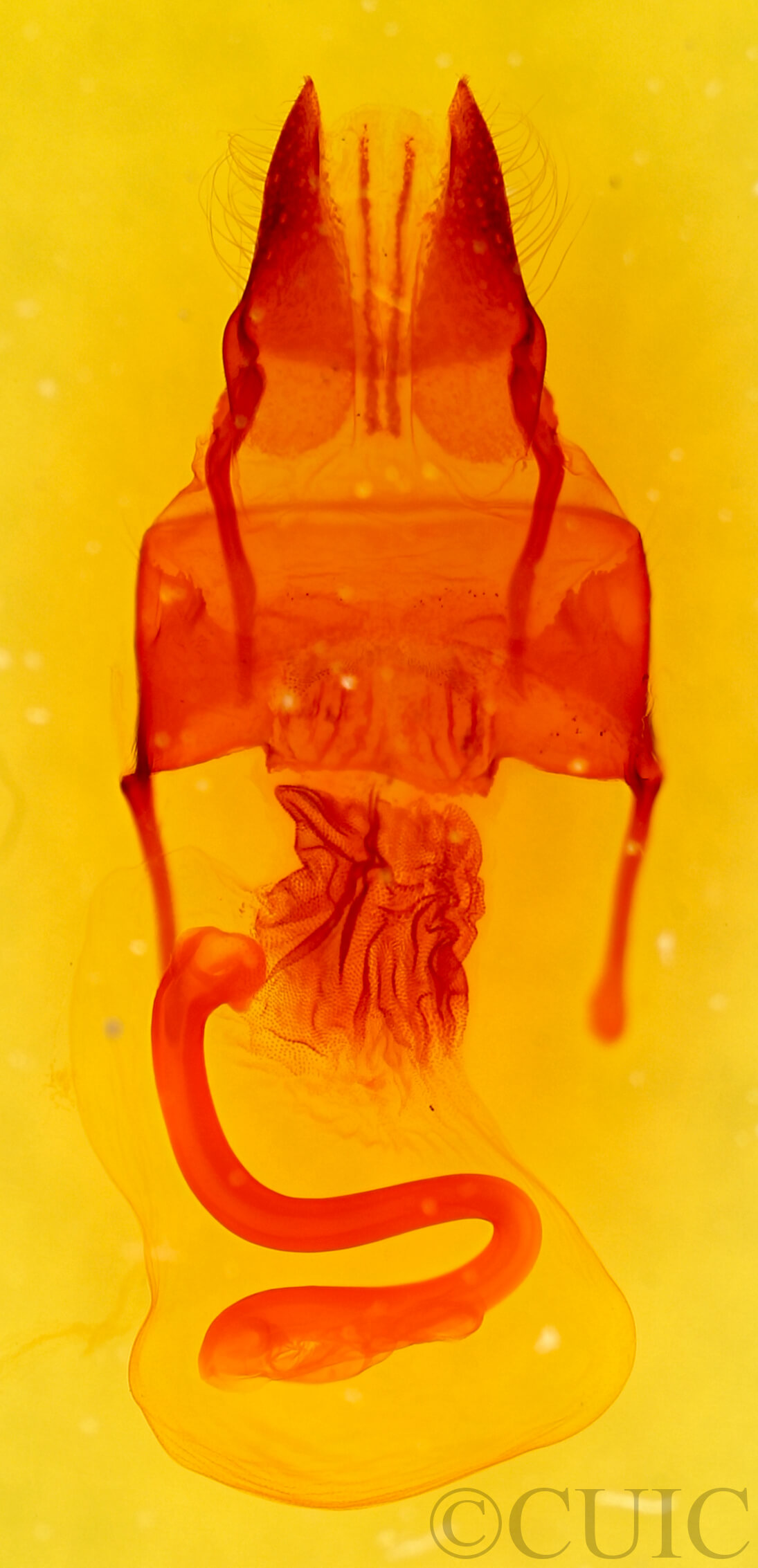 genitalia view of adult Franclemontia interrogans