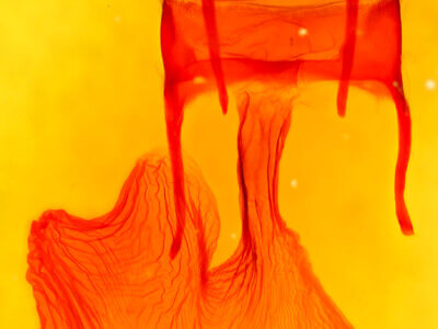 genitalia view of adult Xylomoia chagnoni