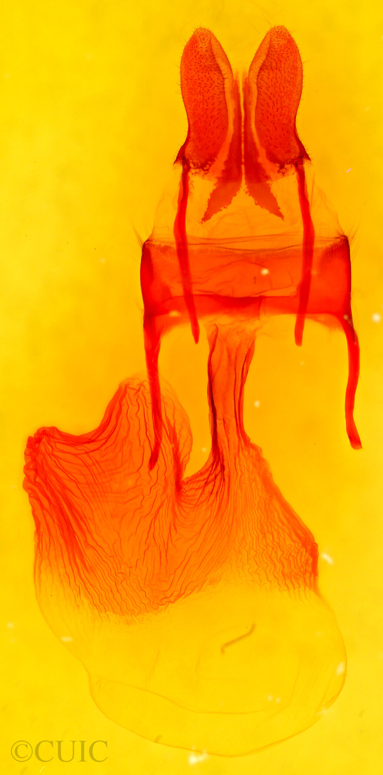 genitalia view of adult Xylomoia chagnoni