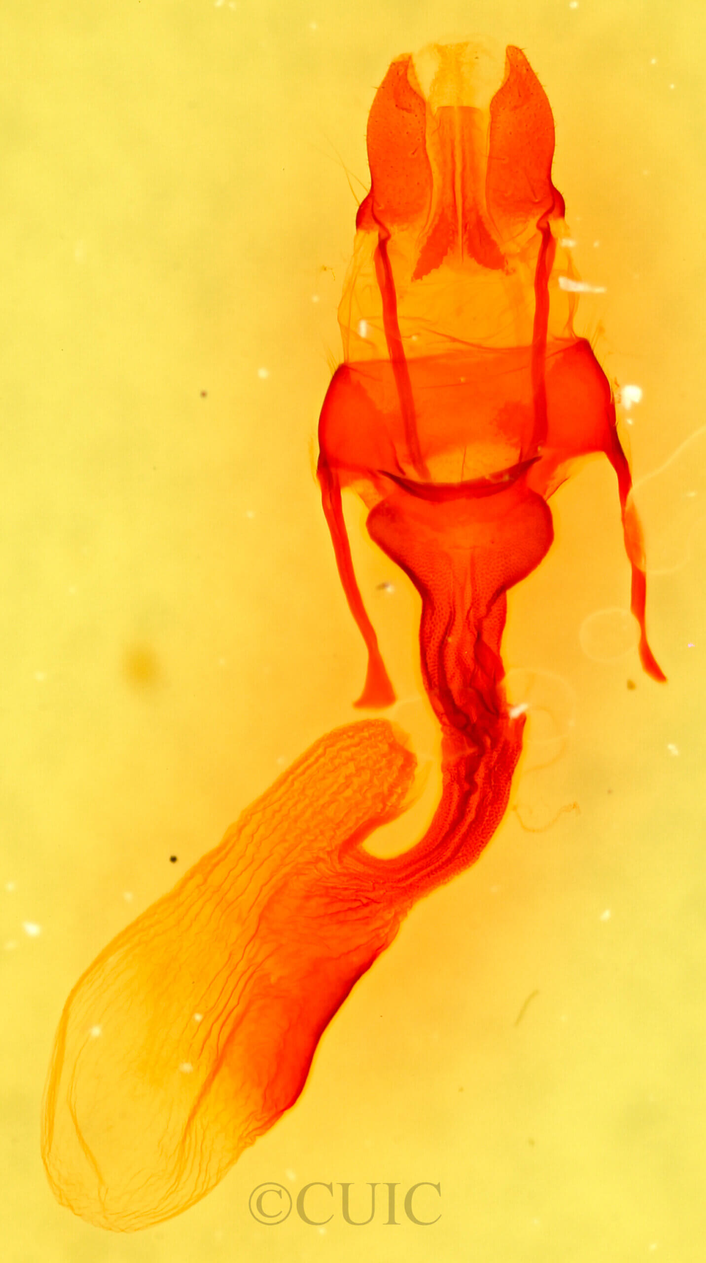 genitalia view of adult Oligia strigilis