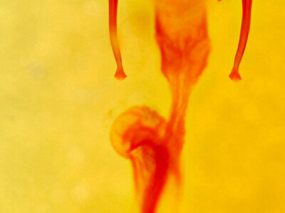 genitalia view of adult Mesoligia furuncula