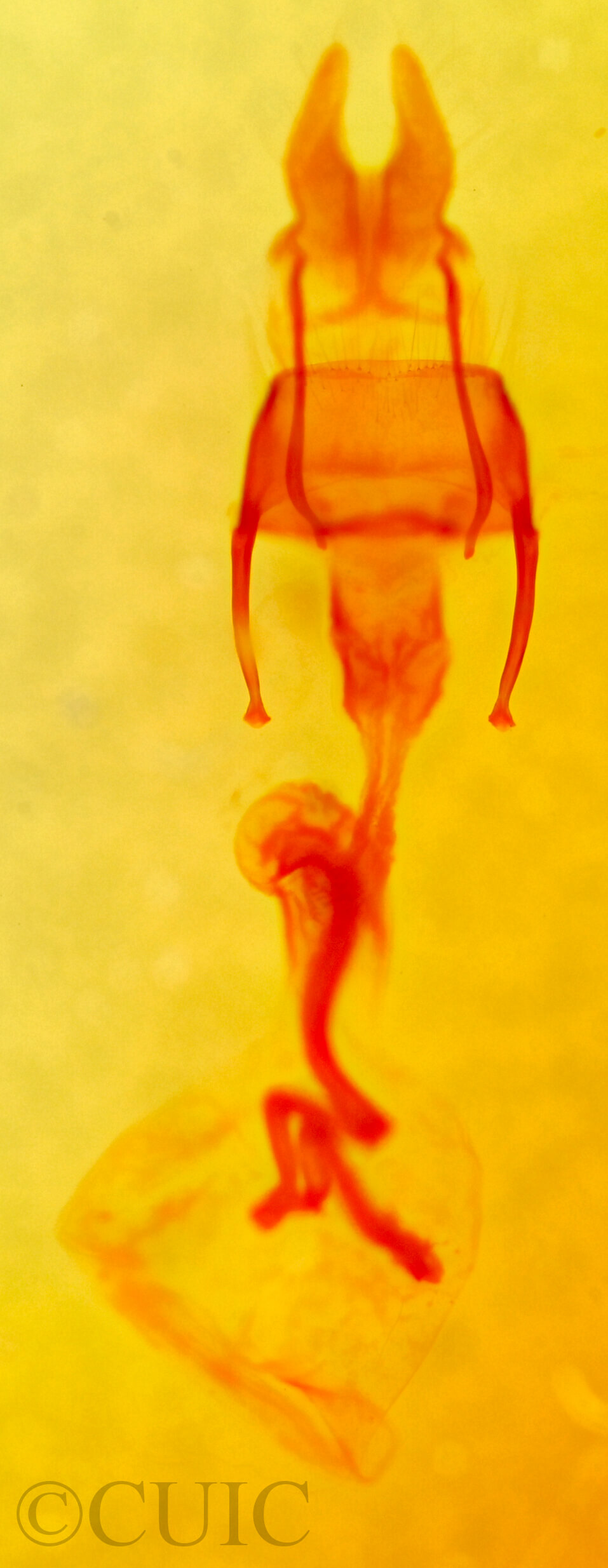 genitalia view of adult Mesoligia furuncula