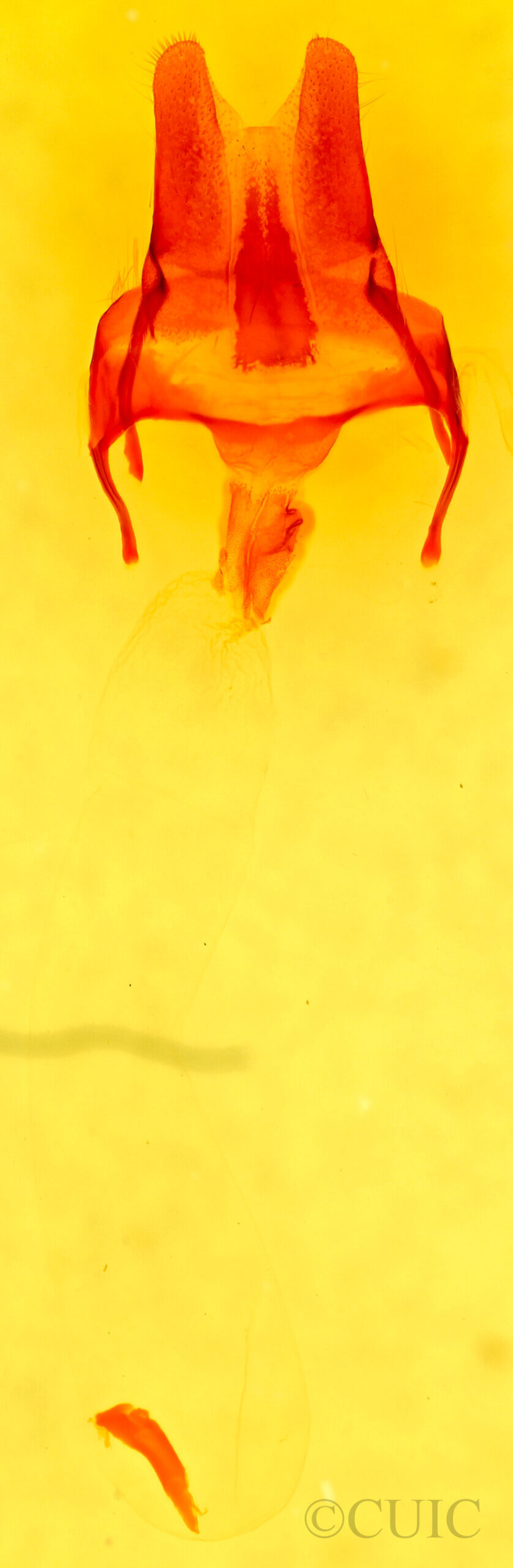 genitalia view of adult Eremobia ochroleuca