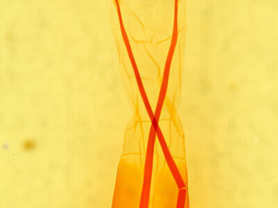 genitalia view of adult Parastichtis suspecta