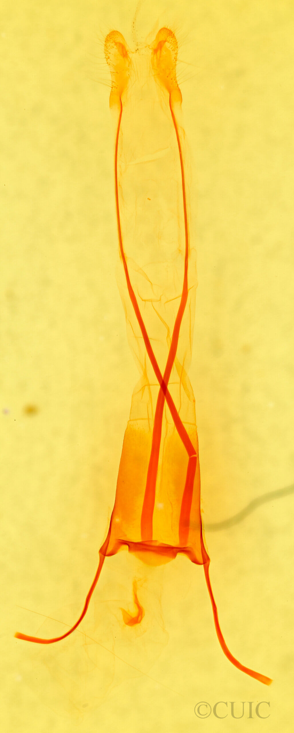 genitalia view of adult Parastichtis suspecta