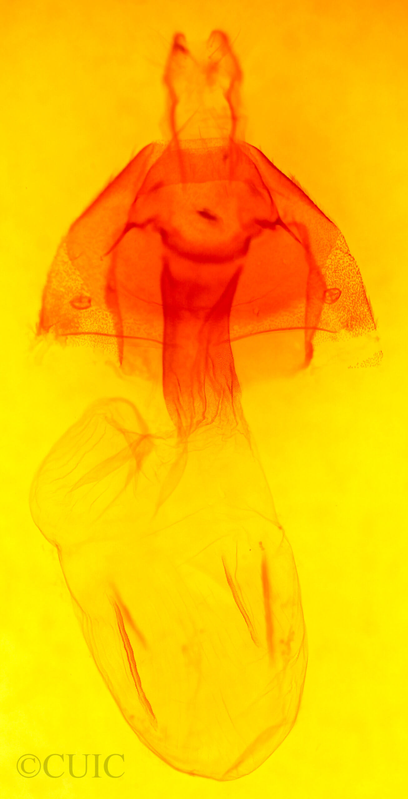 genitalia view of adult Xestia oblata