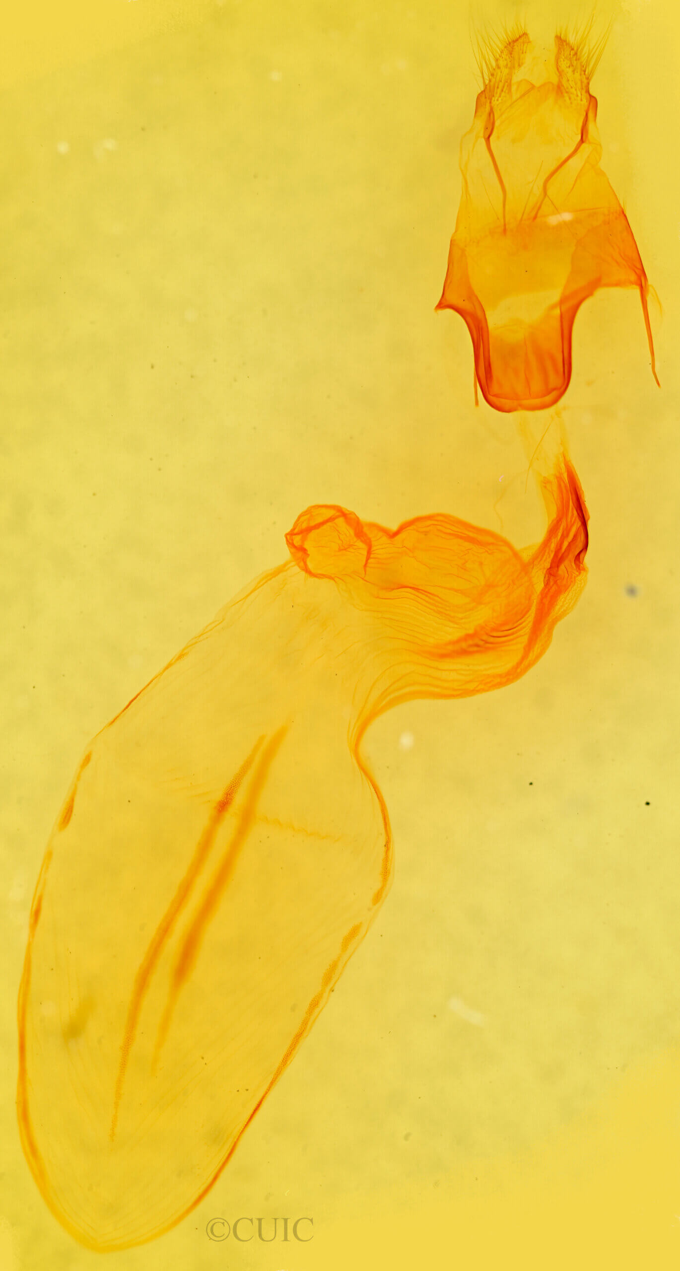 genitalia view of adult Eupsilia vinulenta