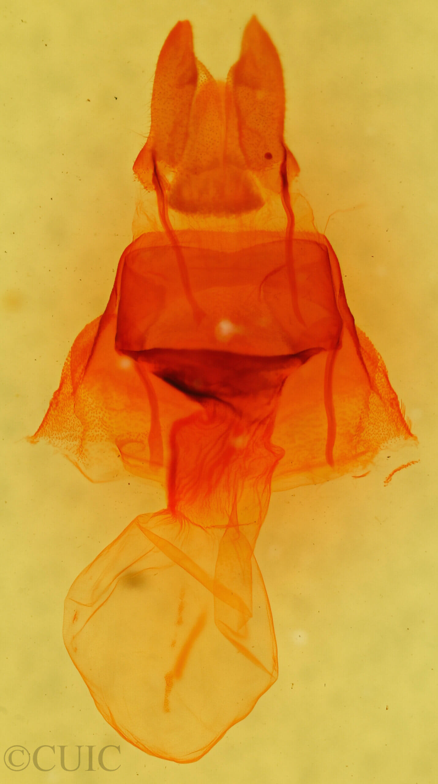 genitalia view of adult Arenostola phragmitidis