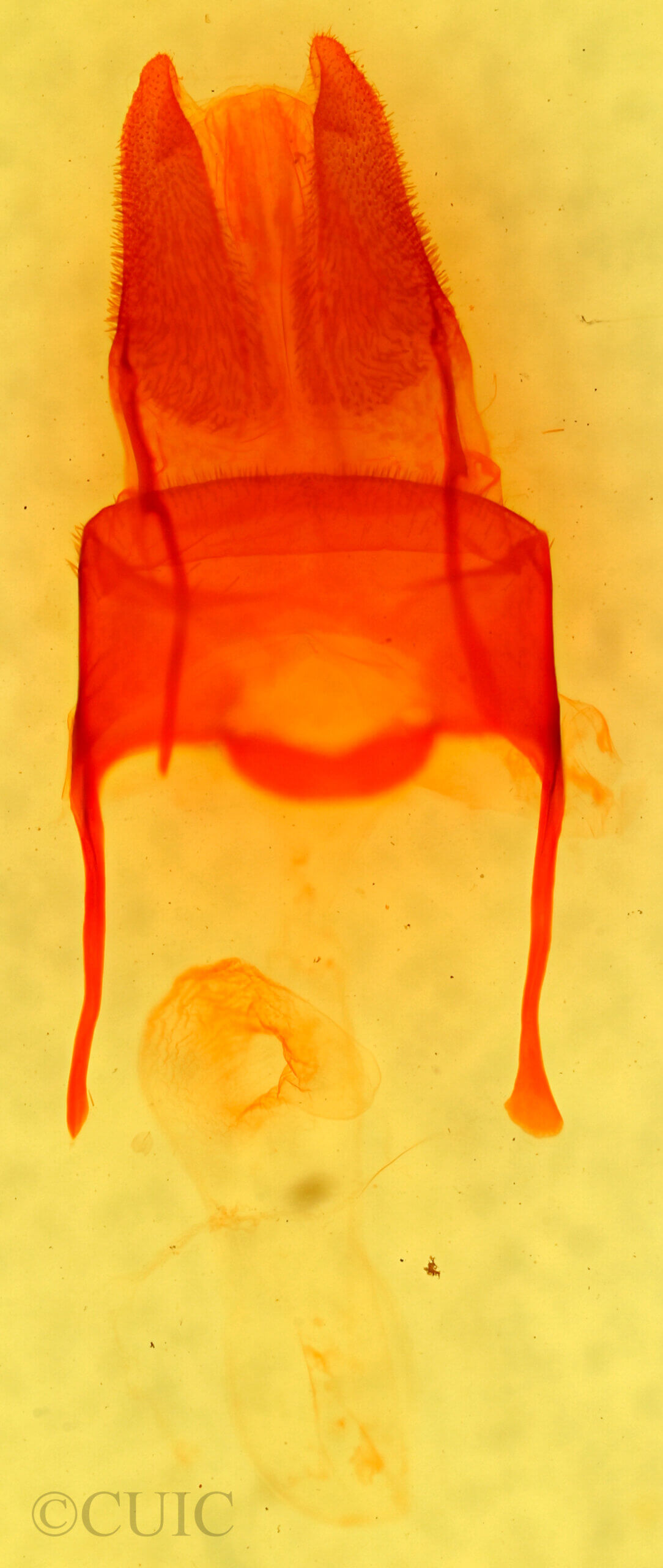 genitalia view of adult Archanara geminipuncta